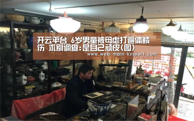 开云平台_6岁男童被母虐打遍体鳞伤 求别调查:是自己顽皮(图)(图3) 开云官网